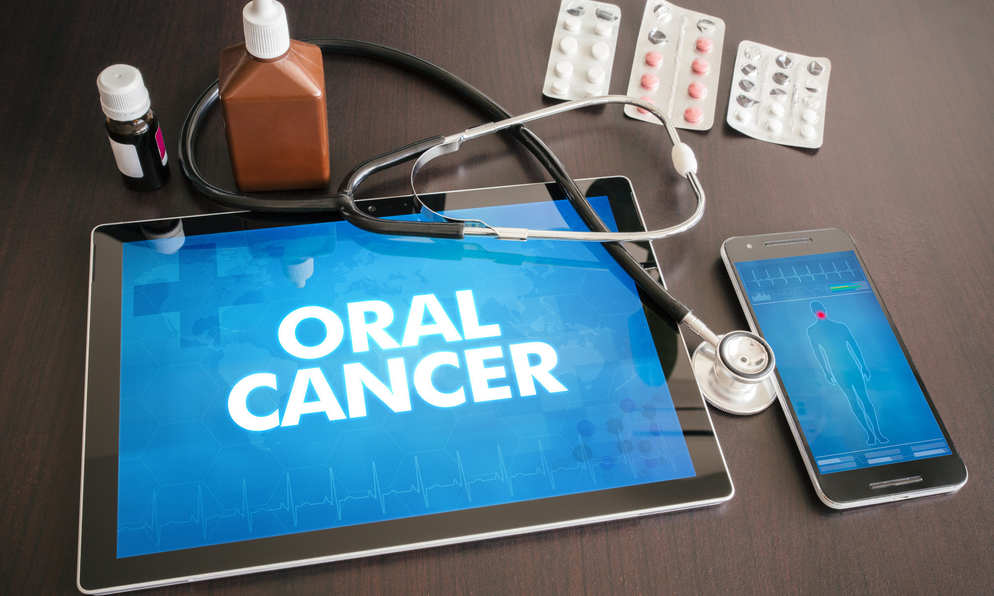 screening for oral cancer